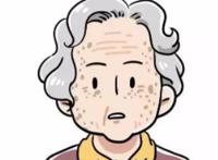 怎样快速去除老年斑小妙招