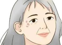 怎样快速去除老年斑小妙招