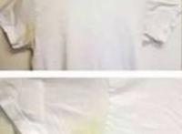 白色衣服发黄怎么洗白小妙招