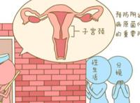 女性妇科有哪些疾病