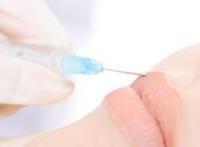 什么是闭口粉刺