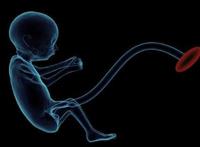 梦见脐带的意思