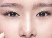 为什么脸色发黄暗沉