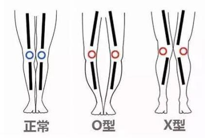 低帮鞋和高帮鞋到底哪个适合自己