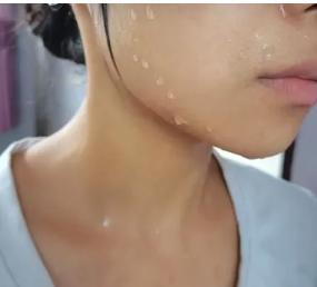 天生皮肤黑还可以变白吗