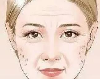 怎样快速去除老年斑小妙招