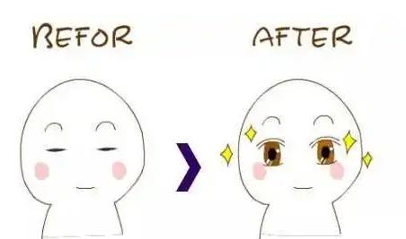 单眼皮突然变双眼皮怎么回事