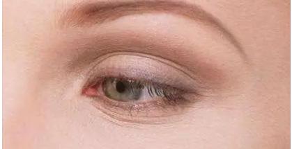 如何正确去除眼部细纹