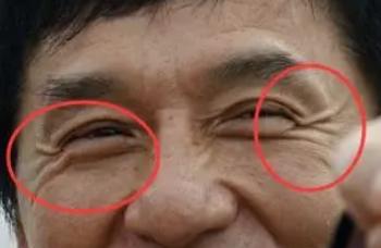 男士消灭鱼尾纹方法