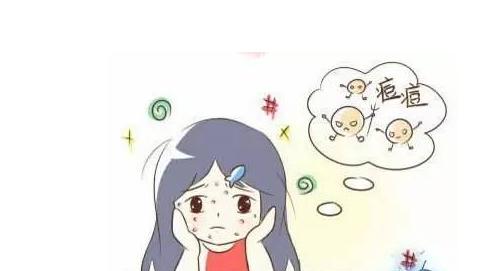 青春痘目前最好的治疗方法是什么