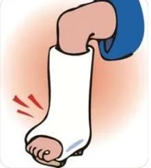 最新法医鉴定轻伤的标准