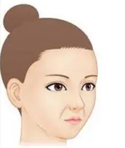 鼻子上有皱纹怎么去除