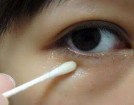 打玻尿酸10几年后