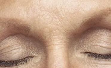 去皱纹的6个小偏方