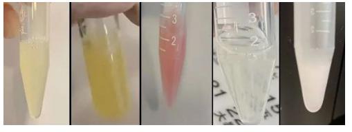 正常男人精子颜色对照