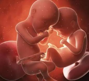怀孕双胞胎早期有什么特征