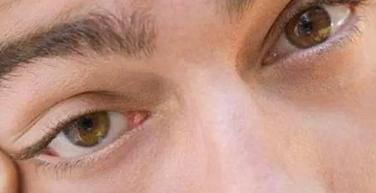 女人右上眼皮跳预兆吉凶