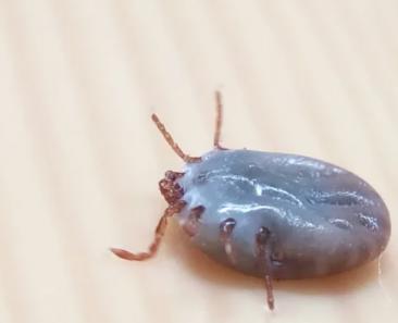 蜱虫咬人后怎么处理