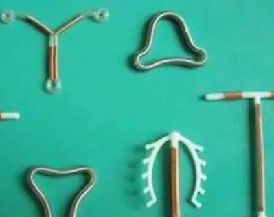 取了环多久可以要孩子