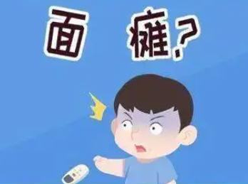 婴儿面瘫的症状