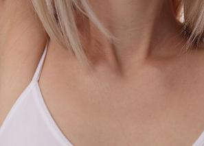 如何消除颈纹最有效的方法