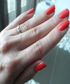 手指甲上出现黑色竖纹