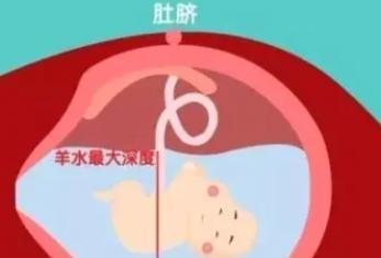 羊水的正常范围是多少
