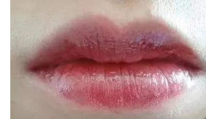 嘴唇正常颜色对照