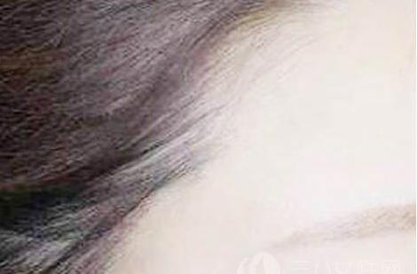 额头去皱纹的方法六种小妙招