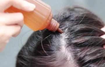 清水洗头可以天天洗吗