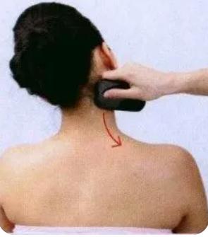 怎么刮痧背部图解