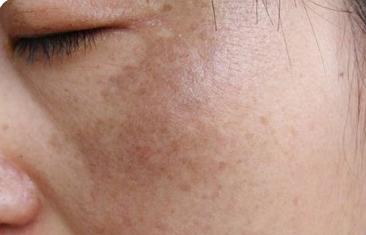 为什么脸色发黄暗沉